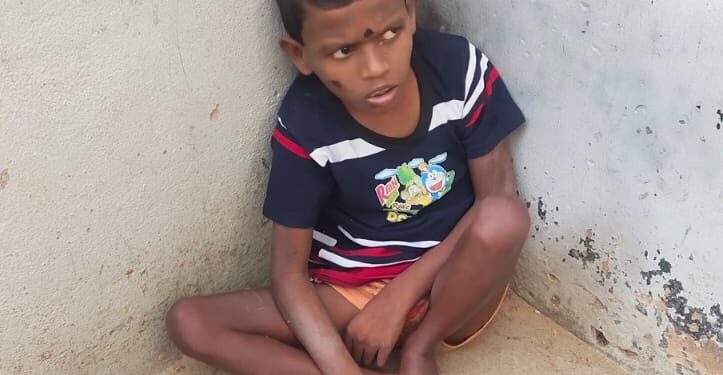 ಬಹು ಅಂಗವೈಕಲ್ಯ; ಬಾಲಕನಿಗೆ ಆಸರೆಯಾದ ಚಿಕ್ಕಮ್ಮ